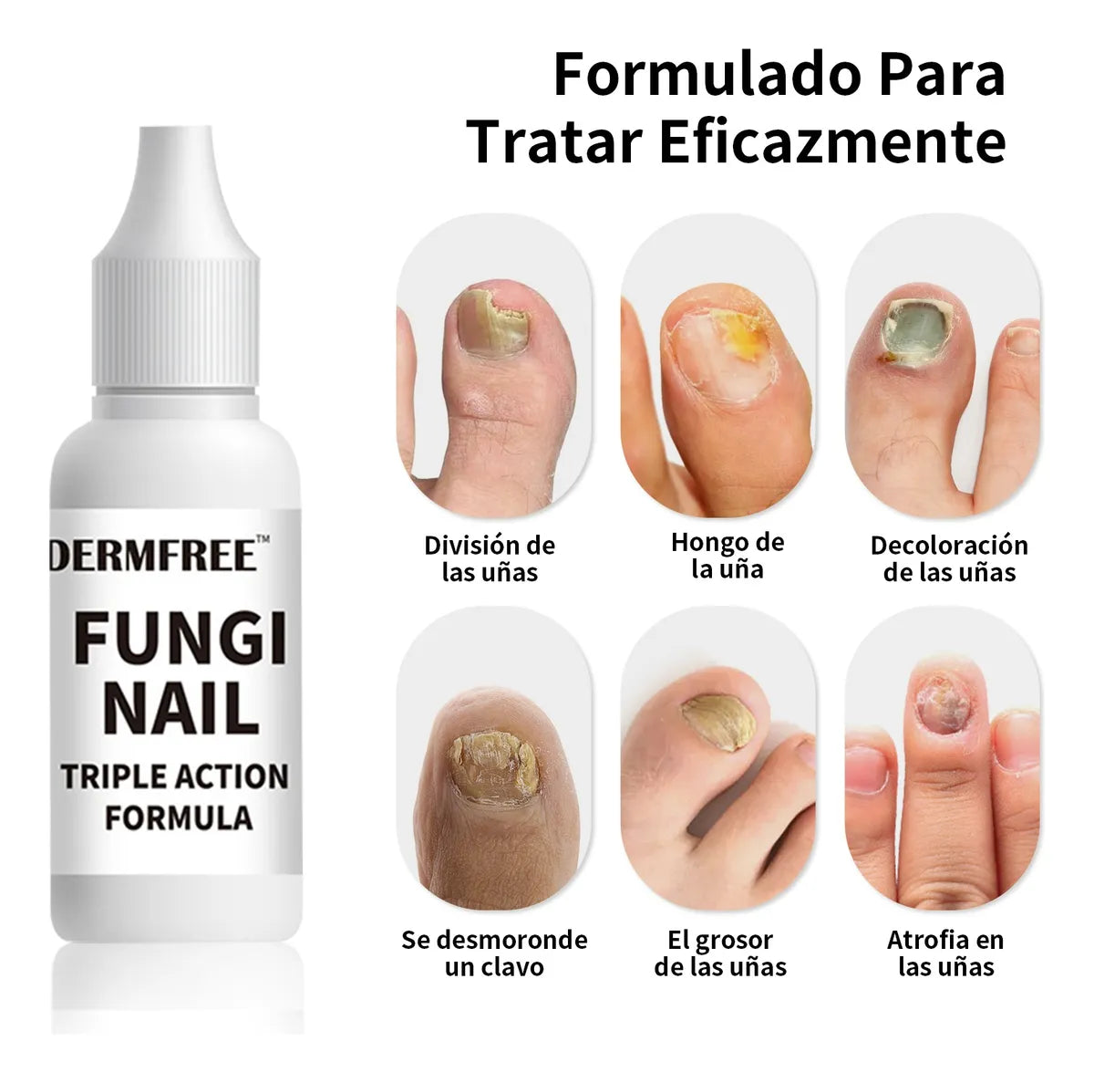 Fungi Nail ™ – Tratamiento Para El Cuidado De Uñas
