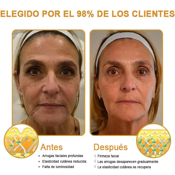 🔥PROMO 2x1 ✨Fuerzero™ Crema Eliminadora De Arrugas Con Veneno De Abeja Y Efecto Botox🔥