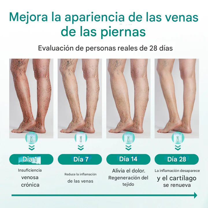 TIMILK (set x 8) parches para la circulacion y venas varicosas