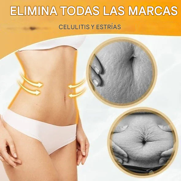 BURN® - Aceite Quemador De Grasa + Reafirmante + Drenaje Linfático