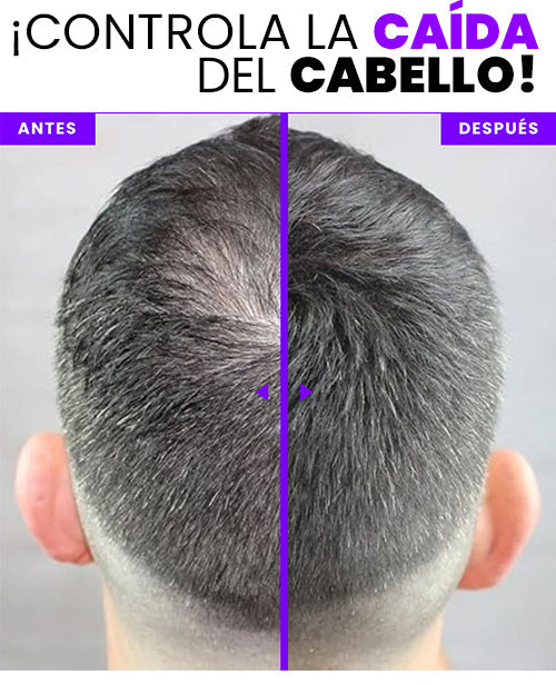 Bunee Pro™ - Eliminador De Canas Y Raíces