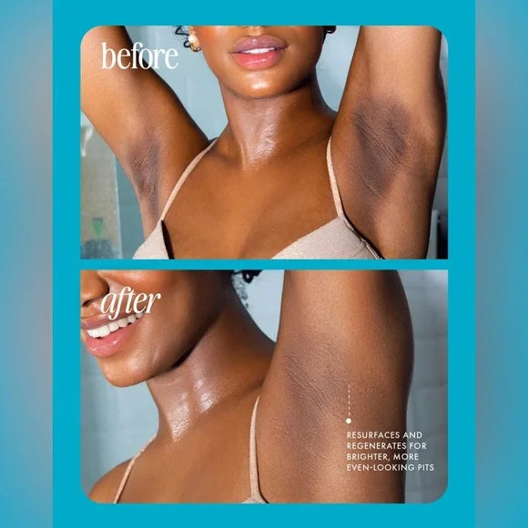 ⚡ Rescate en 5 segundos después de la depilación: ¡Las imperfecciones desaparecen, la piel brilla! Aceite Glass Smooth.