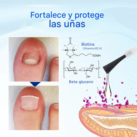 🔥 (Paga 1 Lleva 2 ) Suero para el crecimiento y la reparación de uñas Biancat™ OnyxoGuard🔥