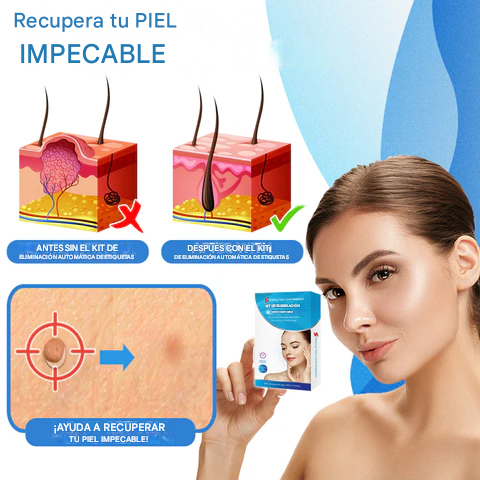 ALCURA™ Kit completo - No más verrugas en la piel