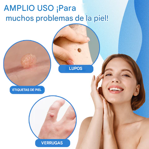 ALCURA™ Kit completo - No más verrugas en la piel