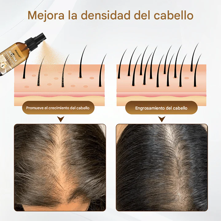 LOVILDS™ Suero revitalizante para el crecimiento del cabello