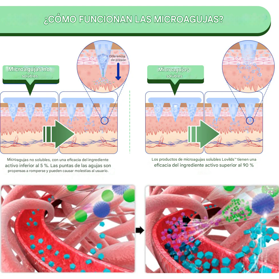 LOVILDS™ SMGT-GLP - Parches Para La Diabetes, La Obesidad Y Las Enfermedades Cardiovasculares