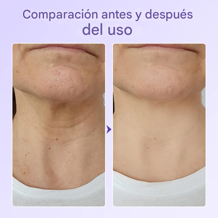 Parche antiarrugas con péptidos Biancat®