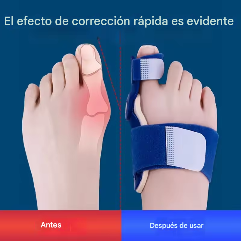 Corrector De Juanete x2 - Pie Izquierdo - Pie Derecho