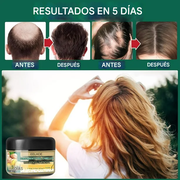 🔥PROMO 2x1 GingerGrow™ Active Formula - Crema De Jengibre Para El Crecimiento Del Cabello🔥