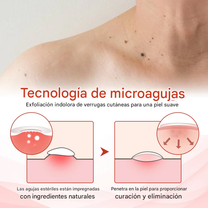 Biancat® Micro parches Para Verrugas