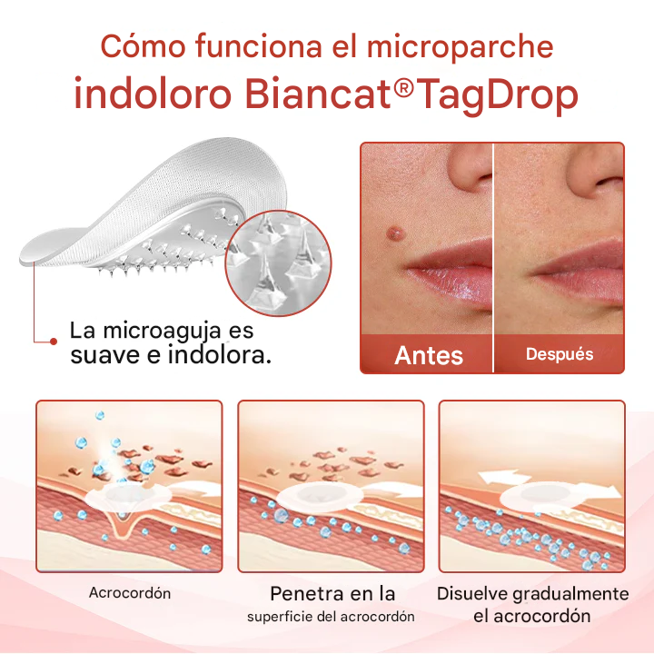 Biancat® Micro parches Para Verrugas