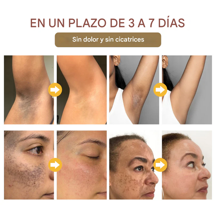 🔥(Promo 2x1)Gel exfoliante para Manchas Oscuras - Biancat™ GlowRevive🔥