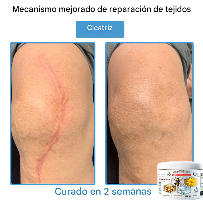 TOD𝐀HOF™ - Crema Para El Tratamiento De La Piel
