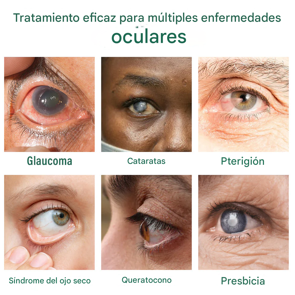 Ourlyard® - Gotas Para Los Ojos - Apto para presbicia, síndrome del ojo seco, glaucoma y cataratas