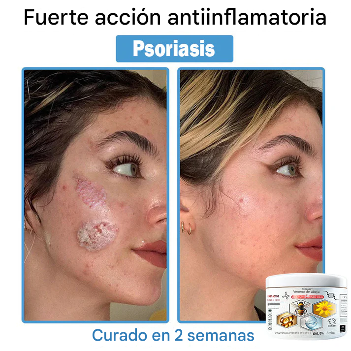 TOD𝐀HOF™ - Crema Para El Tratamiento De La Piel