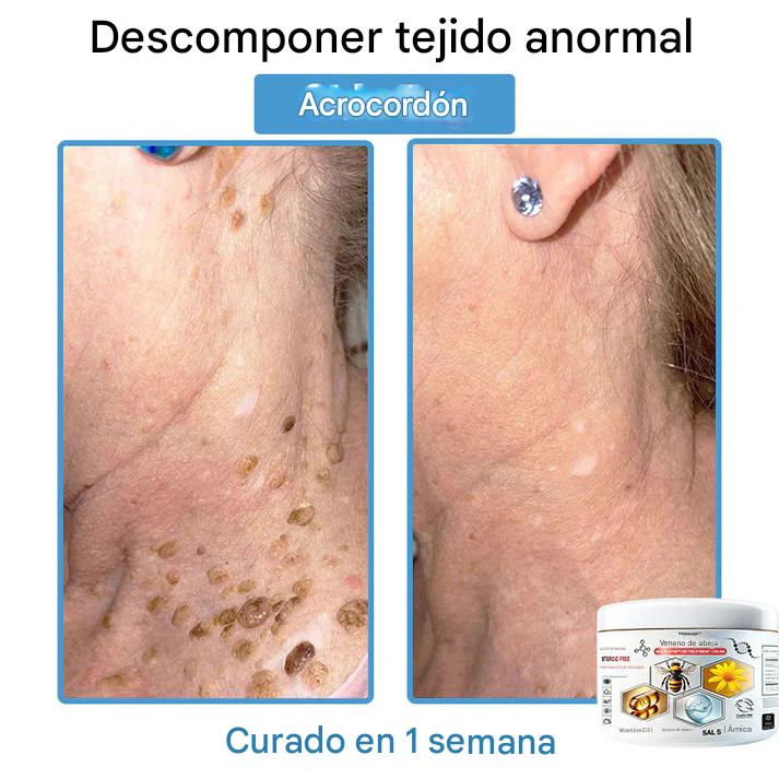 TOD𝐀HOF™ - Crema Para El Tratamiento De La Piel