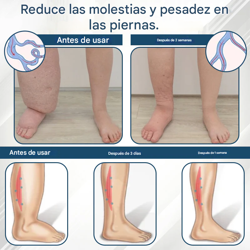 PROMO 2x1 🎁Cvreoz® - Crema De Hierbas Desintoxicante Para Edemas