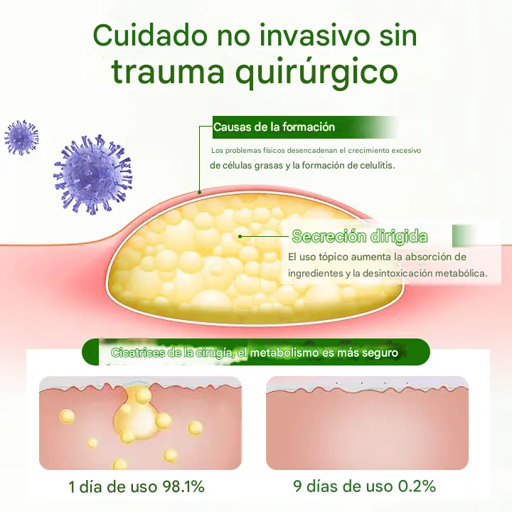 Biancat® - Crema Para La Eliminación De Lipomas