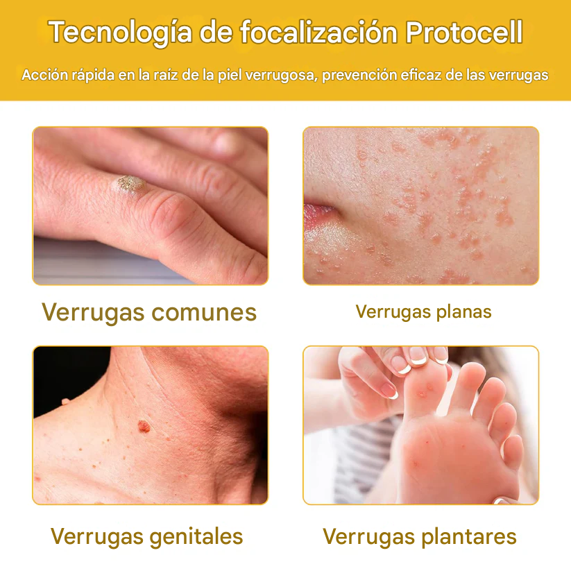 PROMO 2X1 🔥🐝Tratamiento En Aerosol Con Veneno De Abeja Para Lunares Y Verrugas