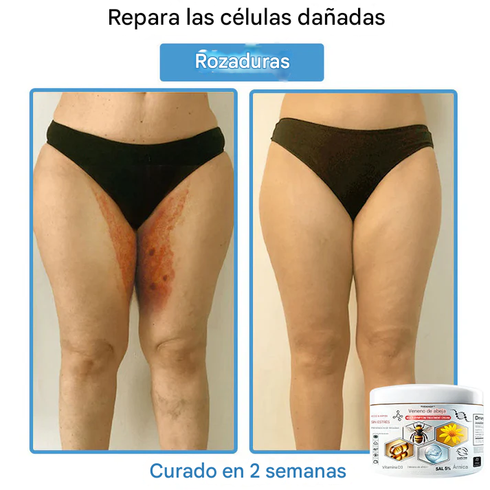 TOD𝐀HOF™ - Crema Para El Tratamiento De La Piel