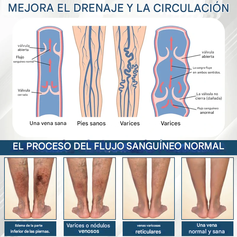 PROMO 2x1 🎁Cvreoz® - Crema De Hierbas Desintoxicante Para Edemas