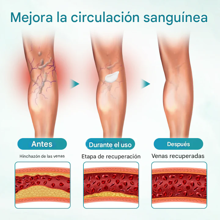 🔥PROMO 2x1 🎁- Crema Para Aliviar Las Venas Timilk® VeinAway