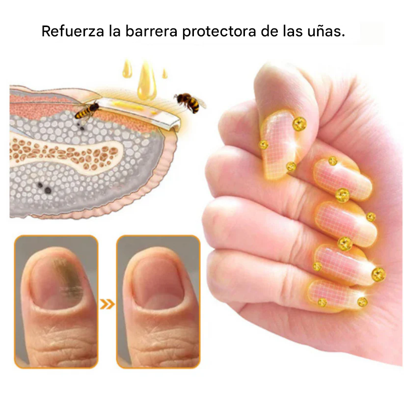 🔥🐝Promo 2x1 Nail Shield™ - Protector de uñas - Detén las uñas dañadas para siempre🐝🔥