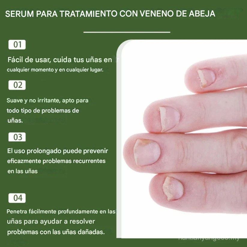 🔥🐝Promo 2x1 Nail Shield™ - Protector de uñas - Detén las uñas dañadas para siempre🐝🔥