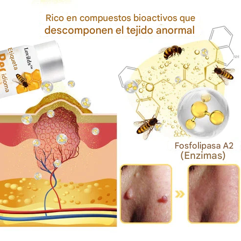 PROMO 2X1 🔥🐝Tratamiento En Aerosol Con Veneno De Abeja Para Lunares Y Verrugas