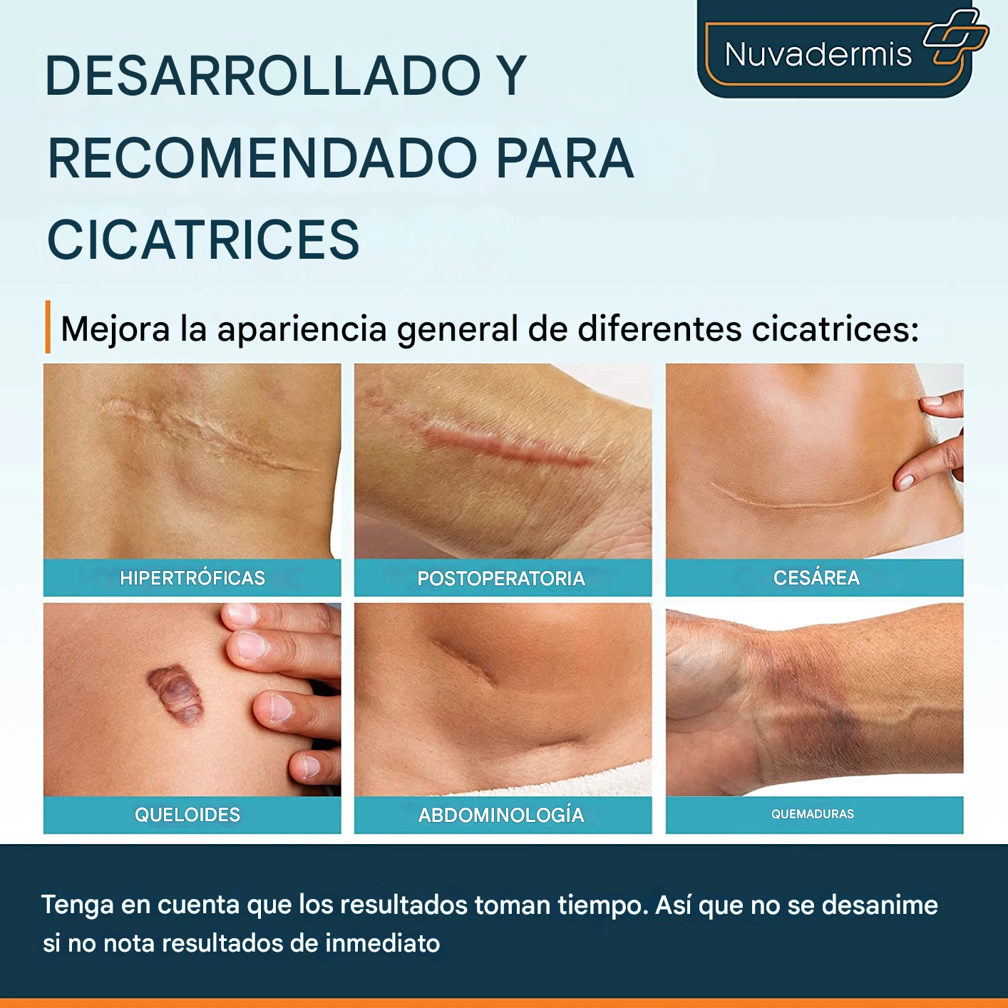 🔥PROMO 2X1 🔥DermaSilk® Profesional - Spray Para Cicatrices