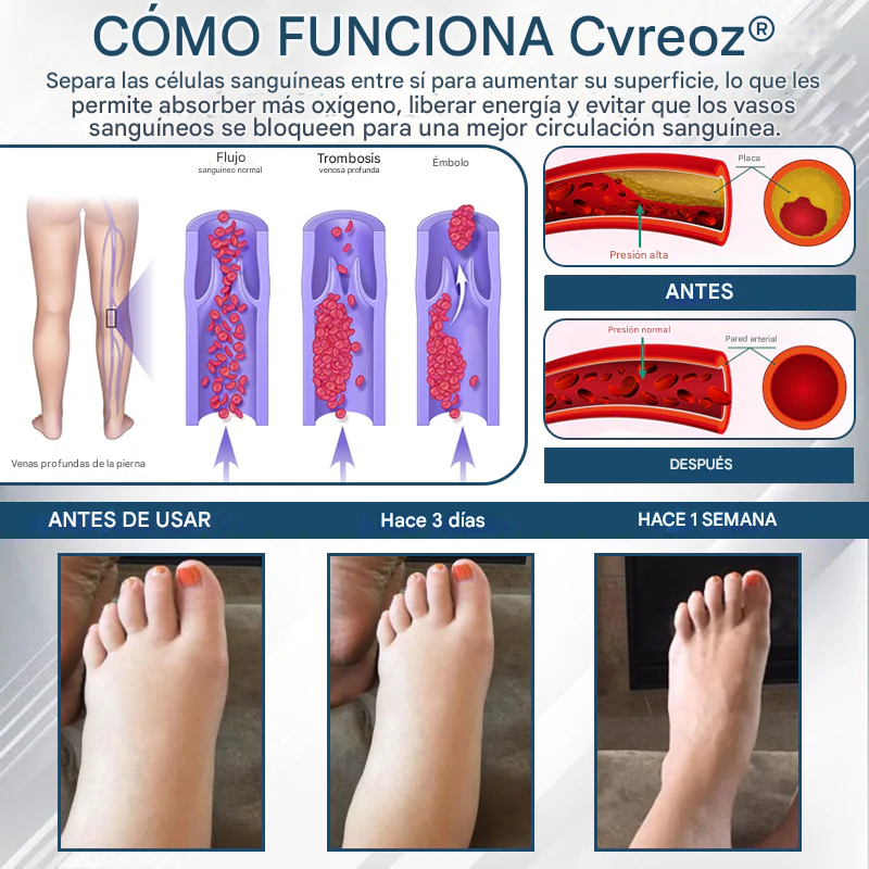 PROMO 2x1 🎁Cvreoz® - Crema De Hierbas Desintoxicante Para Edemas