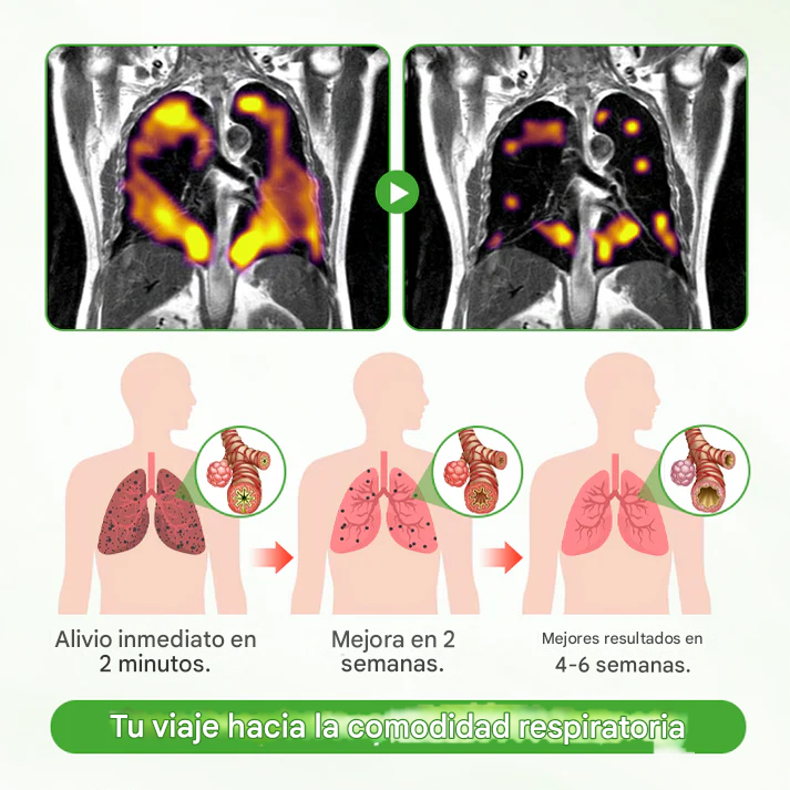 🔥PROMO 2X1 🔥Timilk® - Purificador De Pulmones