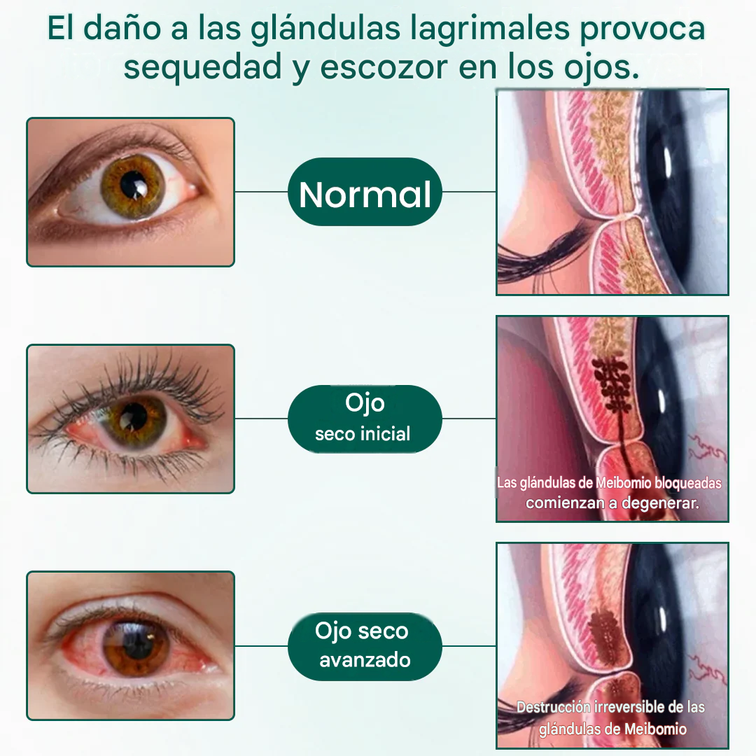 Sérum - OptiClear Nano Eye Roller Serum