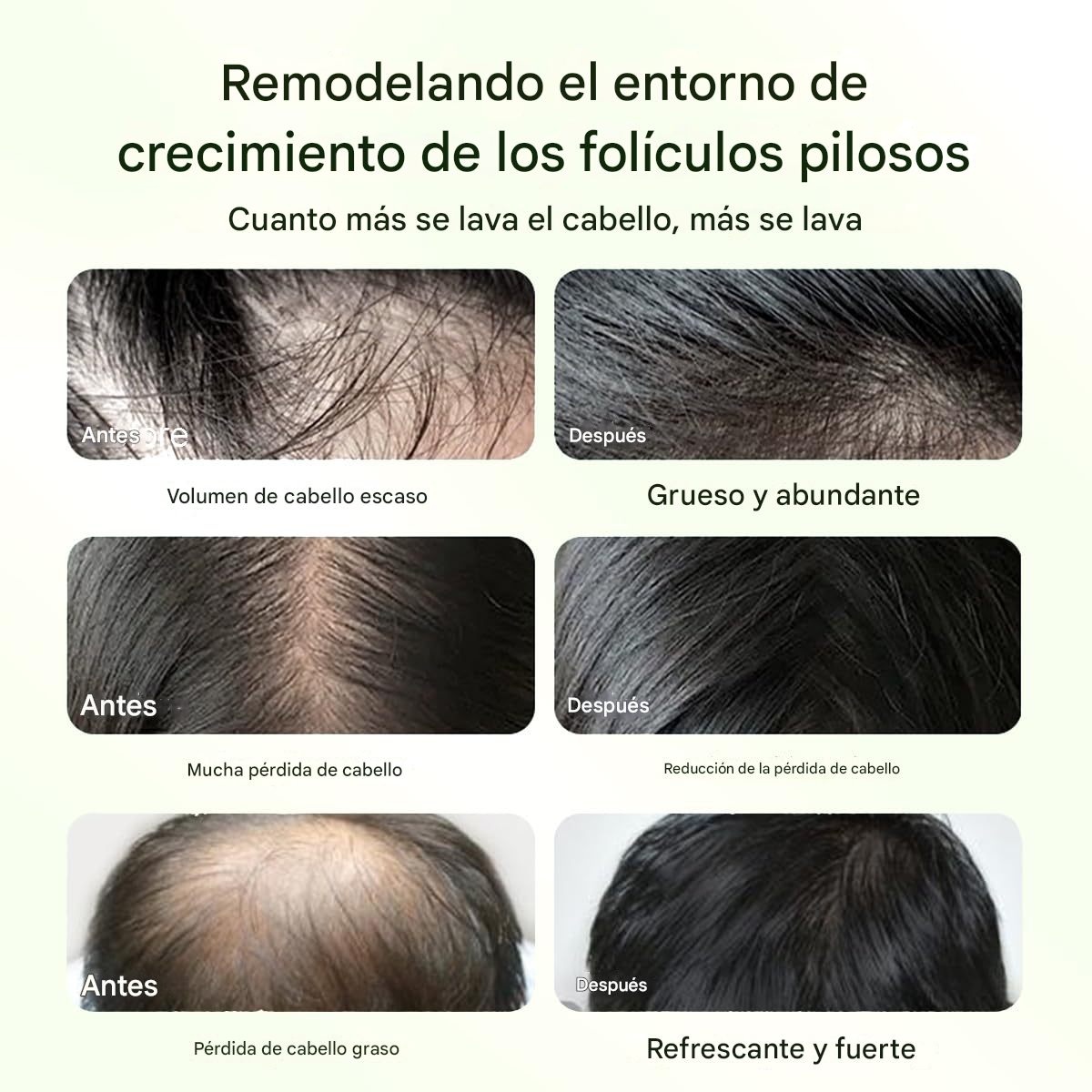 Shampoo De Aceite De Batana Para Crecimiento Del Cabello
