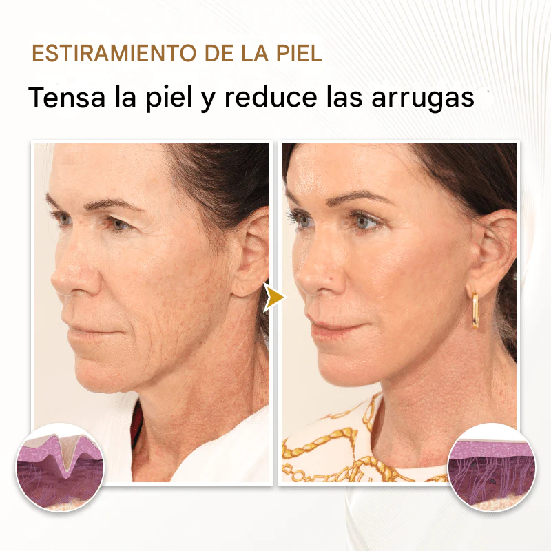 Suero reafirmante para la piel Biancat™ DermRejuv