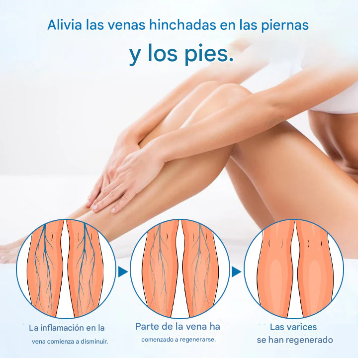 Trimil® Spray protector de venas a base de hierbas