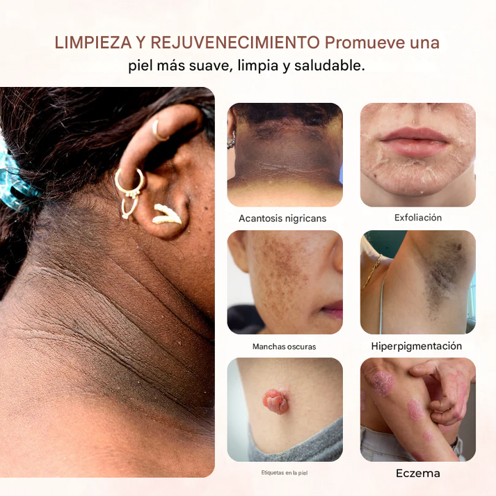 🔥(Promo 2x1)Gel exfoliante para Manchas Oscuras - Biancat™ GlowRevive🔥