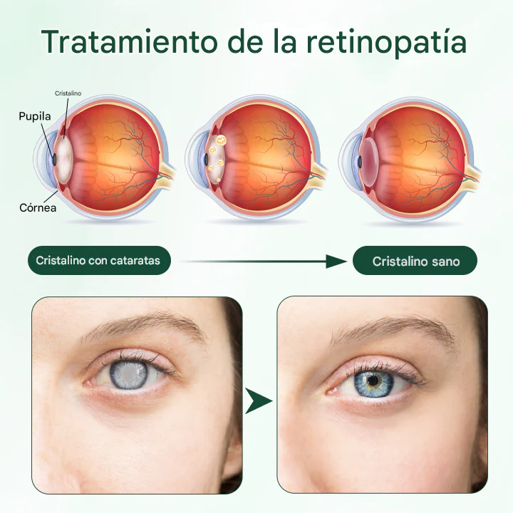 Toallitas Limpiadoras Terapéuticas - Biancat™ EyeRelief