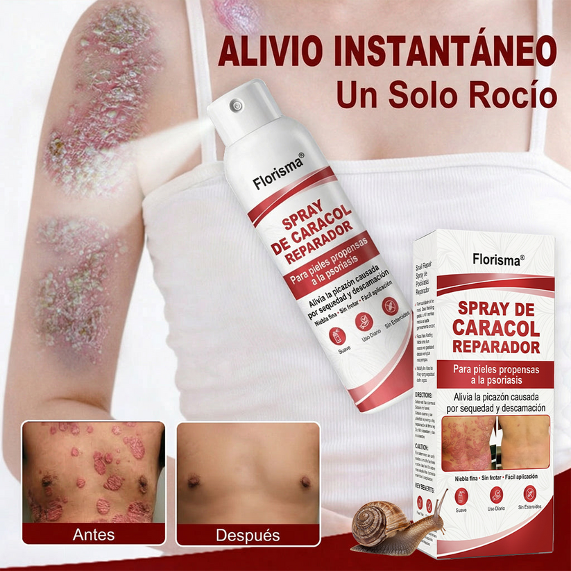 Spray De Cadacol Reparador Para piel Con Psoriasis, Picazón Y Descamación