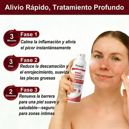 Spray De Cadacol Reparador Para piel Con Psoriasis, Picazón Y Descamación