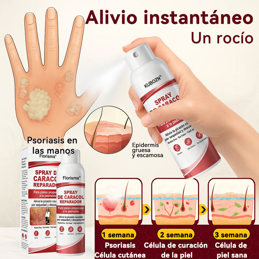 Spray De Cadacol Reparador Para piel Con Psoriasis, Picazón Y Descamación