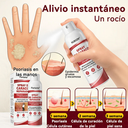 Spray De Cadacol Reparador Para piel Con Psoriasis, Picazón Y Descamación