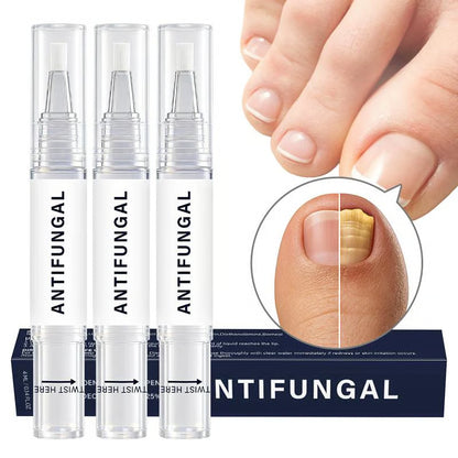 Lápiz renovador de uñas: revitaliza las uñas opacas y dañadas. (Pack x3, x6, x9)