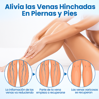 VeinGuard: Elimina las varices rápidamente