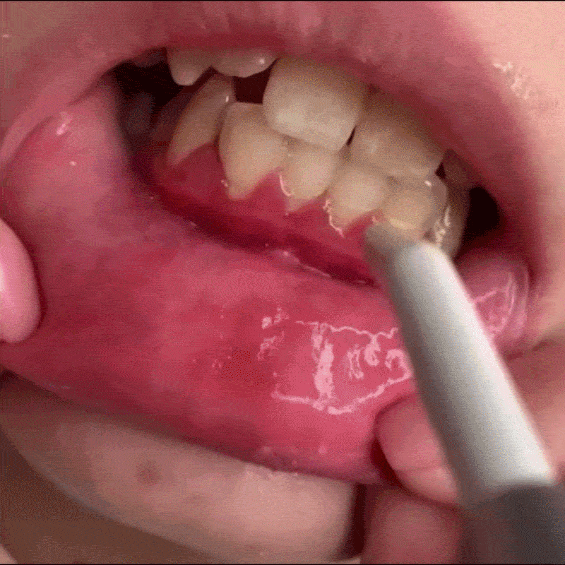 Pasta Dental Con Flúor - SensiGum
