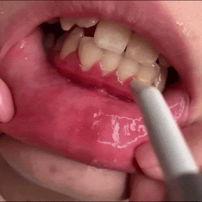 Pasta Dental Con Flúor - SensiGum