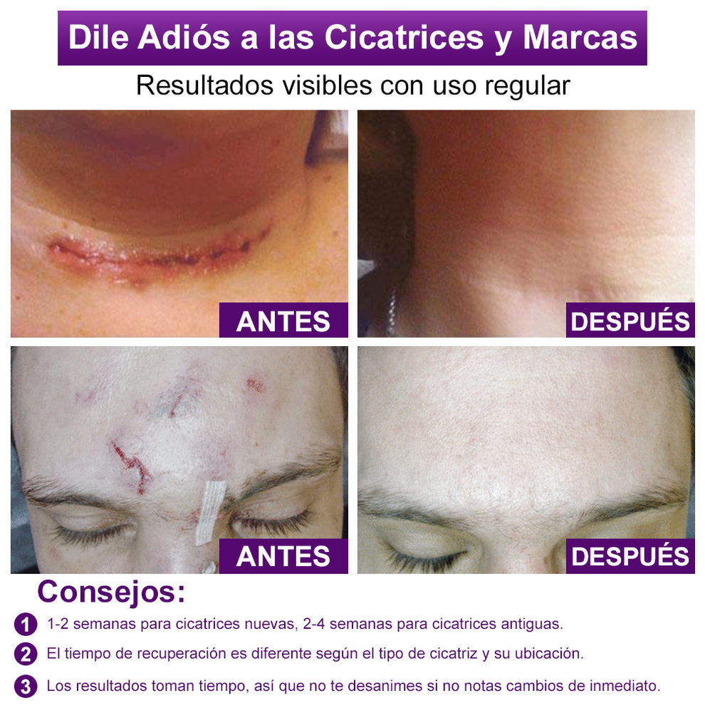 flysmus - Gel Para Cicatrices