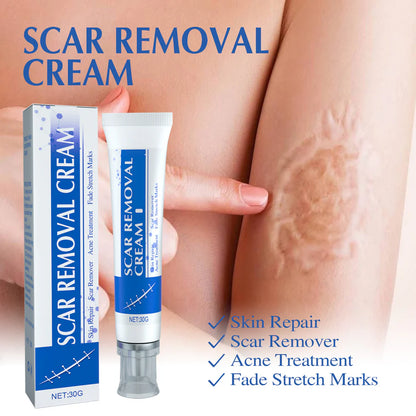 Scar Removal Cream - Crema reparadora de cicatrices para hombres y mujeres