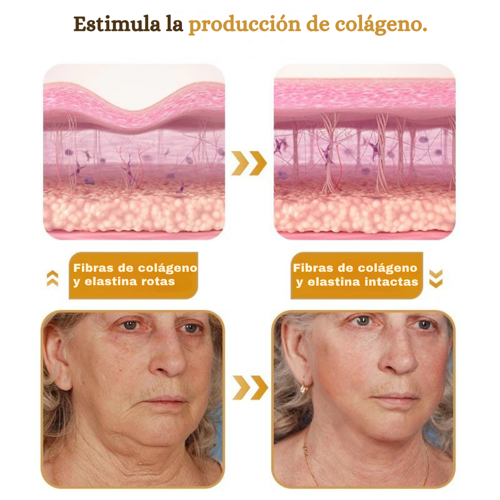 Botox - Crema para eliminar arrugas con Botox y veneno de abeja
